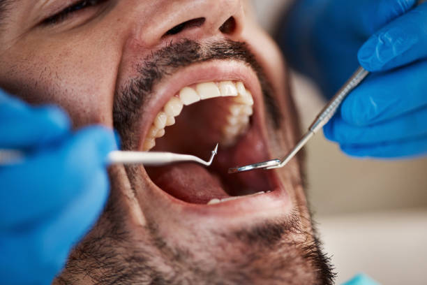 Best Emergency Dental Extractions in Leslie, MI